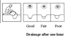 soil drainage figure